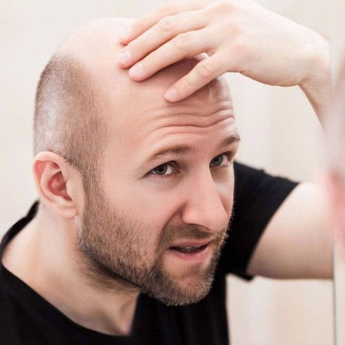 Bald Truth Or Misconception? Understanding The Relationship Between Masturbation And Hair Loss